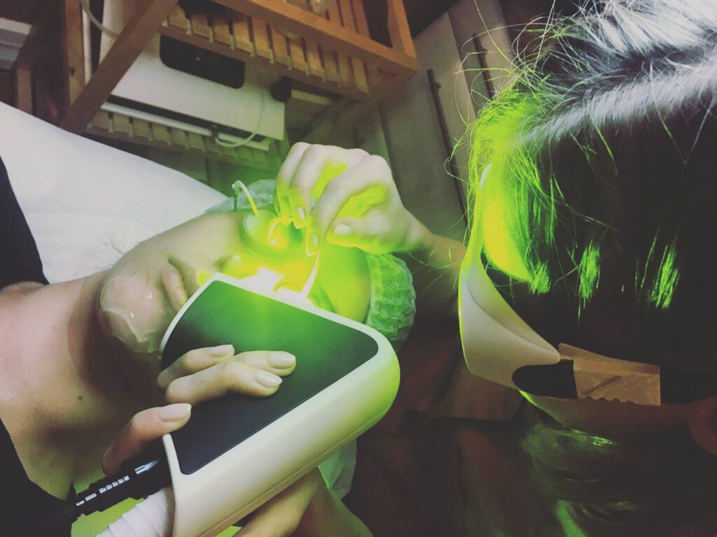 Trądzik różowaty – znajdź przyczynę i pozbądź się go raz na zawsze! – Face and Body Institute