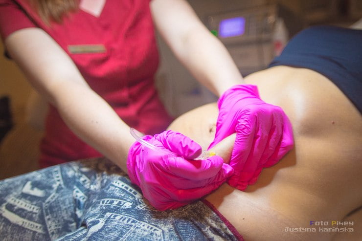 BEAUTY TEST: PŁASKI BRZUCH – Face and Body Institute