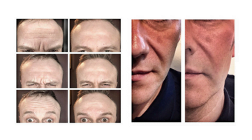 Estetyka pod krawatem – Face and Body Institute