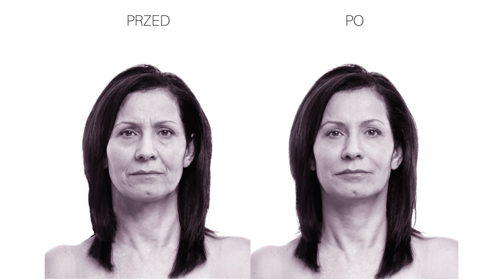 Piękna starość – Face and Body Institute