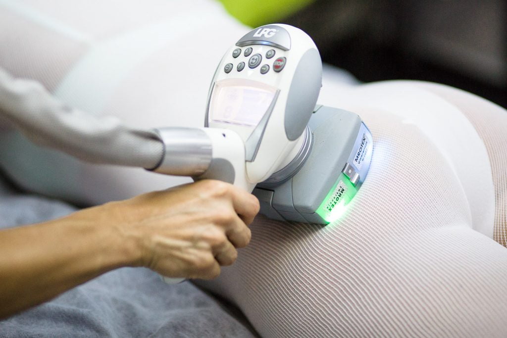 W jaki sposób fala uderzeniowa Storz medical leczy cellulit?