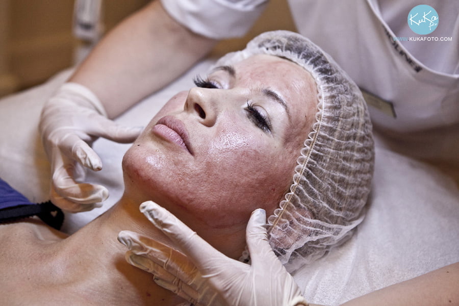 Acne rosacea - find the cause and get rid of it once and for all!