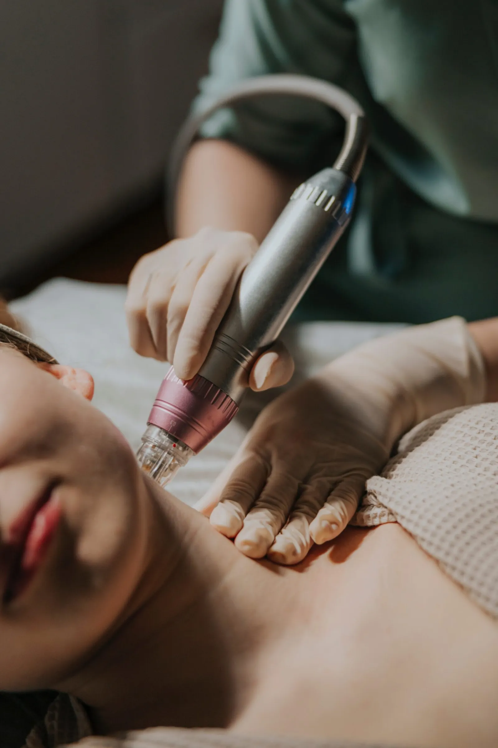 Rejuvenation of the neck and décolleté