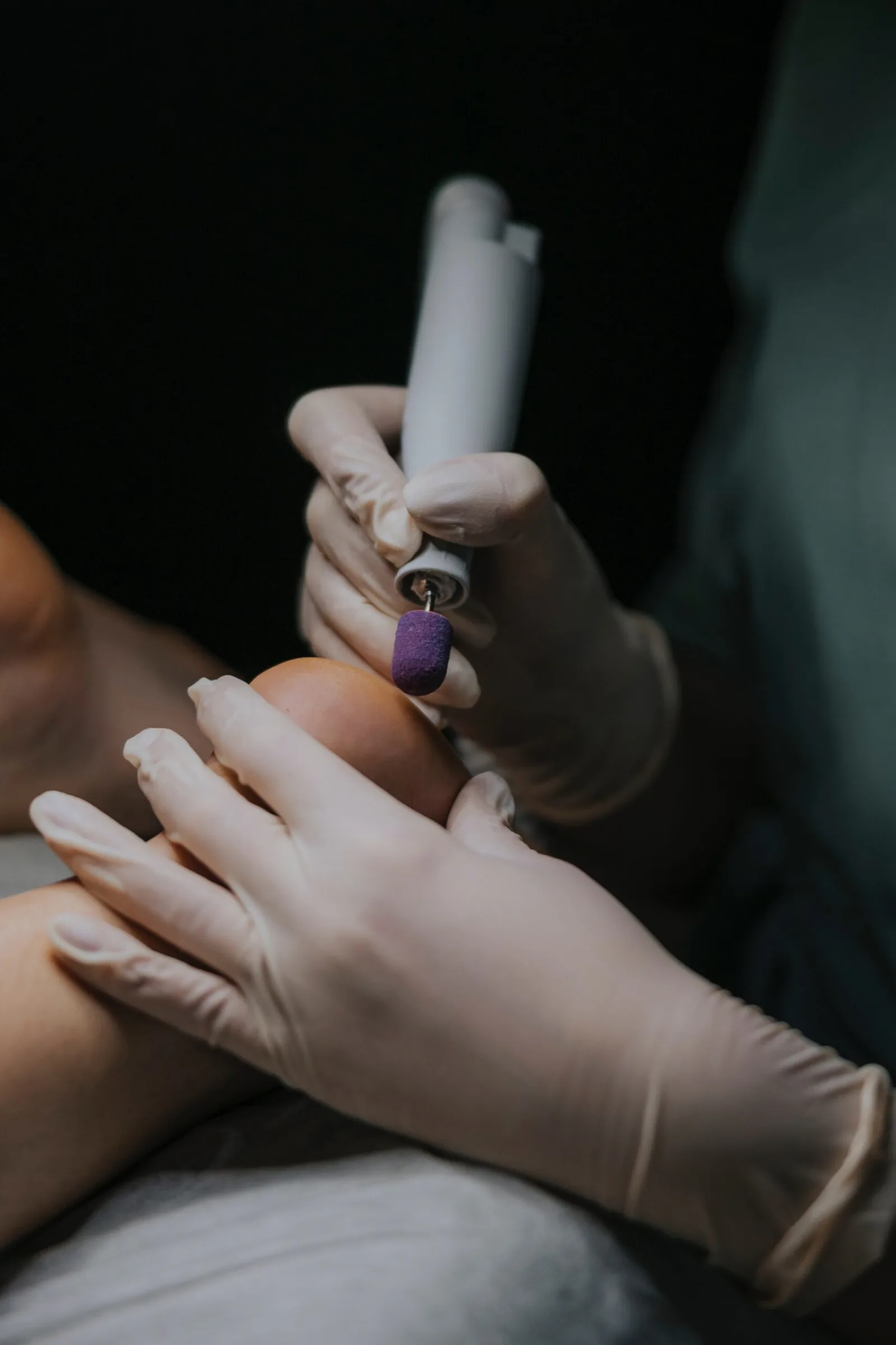 Development of lesioned nails
