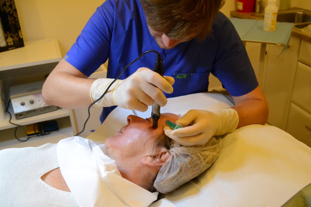 Dermapen + osocze = kolejny krok do młodości – Face and Body Institute