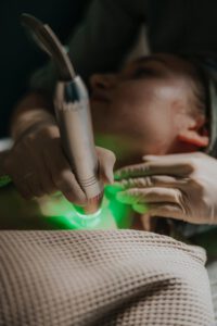 Frakcyjna radiofrekwencja mikroigłowa - Face & Body Institute