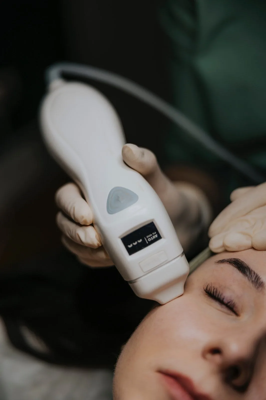 Fractional skin resurfacing — a treatment at Face and Body Institute in Kraków