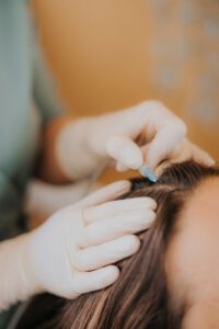 Mezoterapia trychologiczna - Face & Body Institute