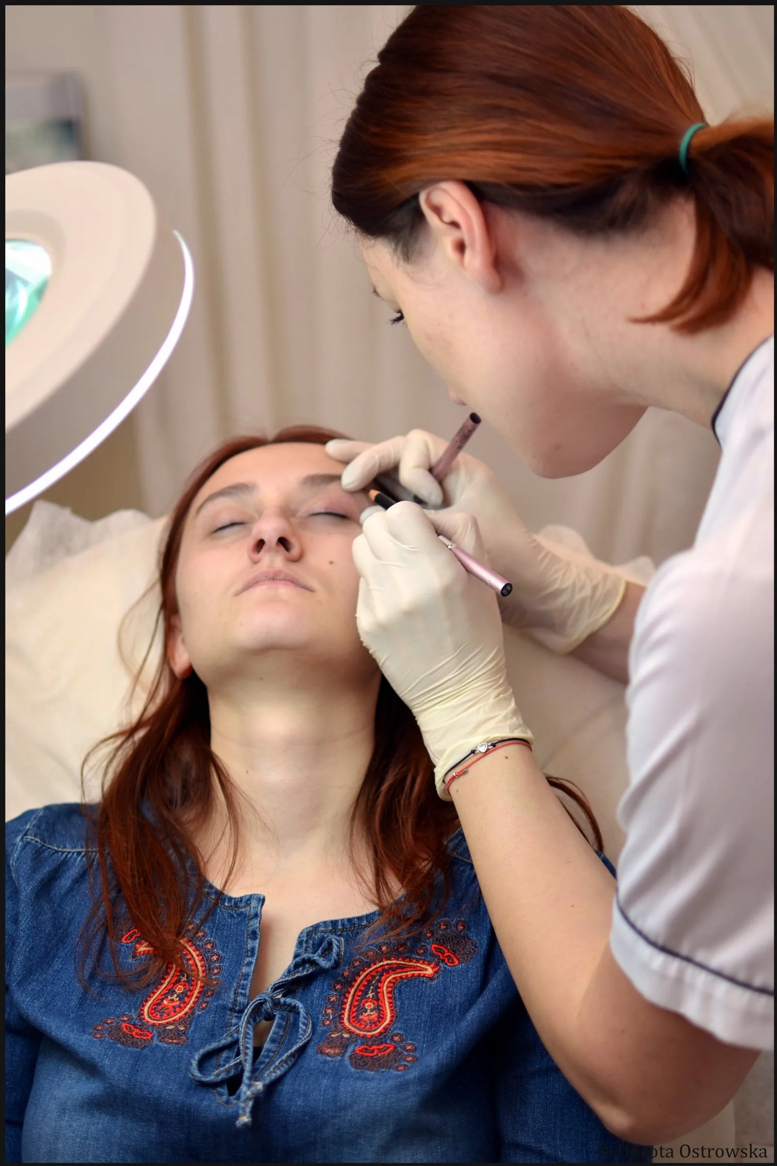 Drooping eyebrows