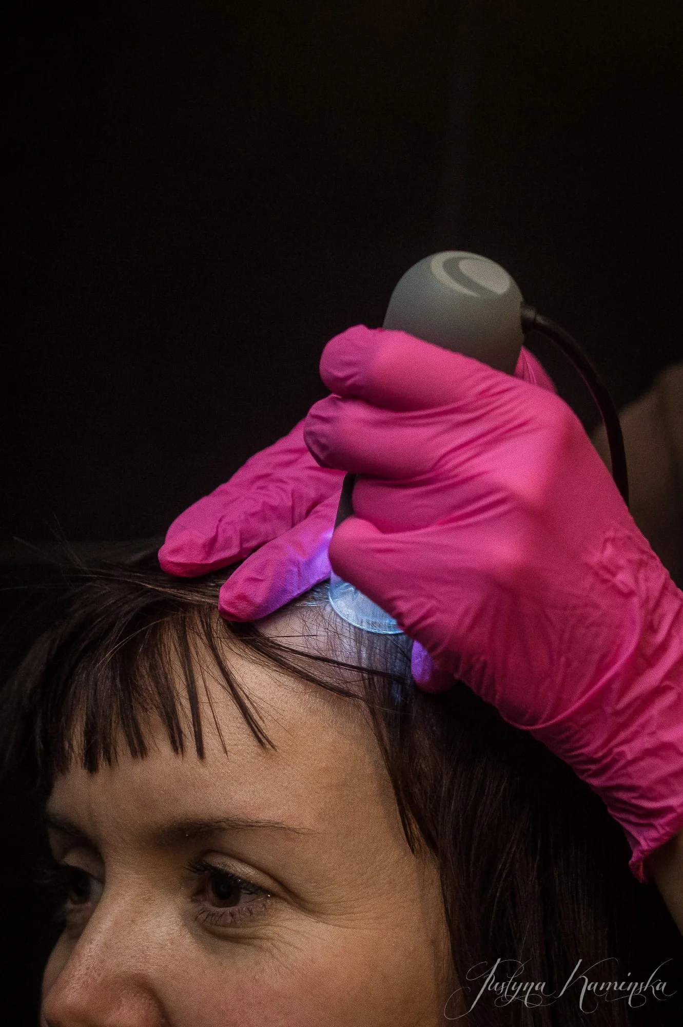 Dlon w rekawiczce prowadzi glowice LED po przedzialku skory glowy