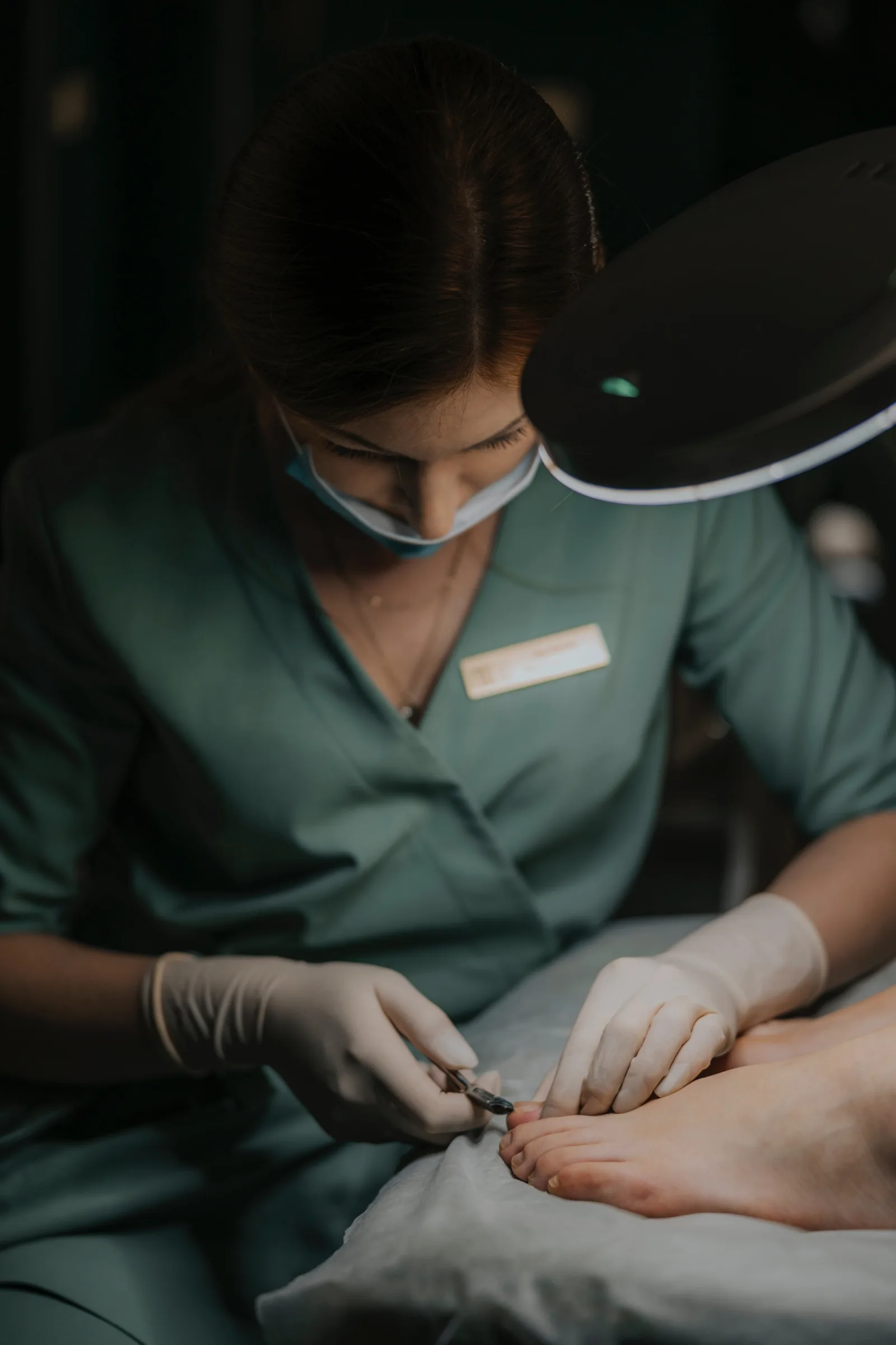 Removal of warts on the feet